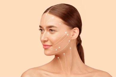 Face Lift